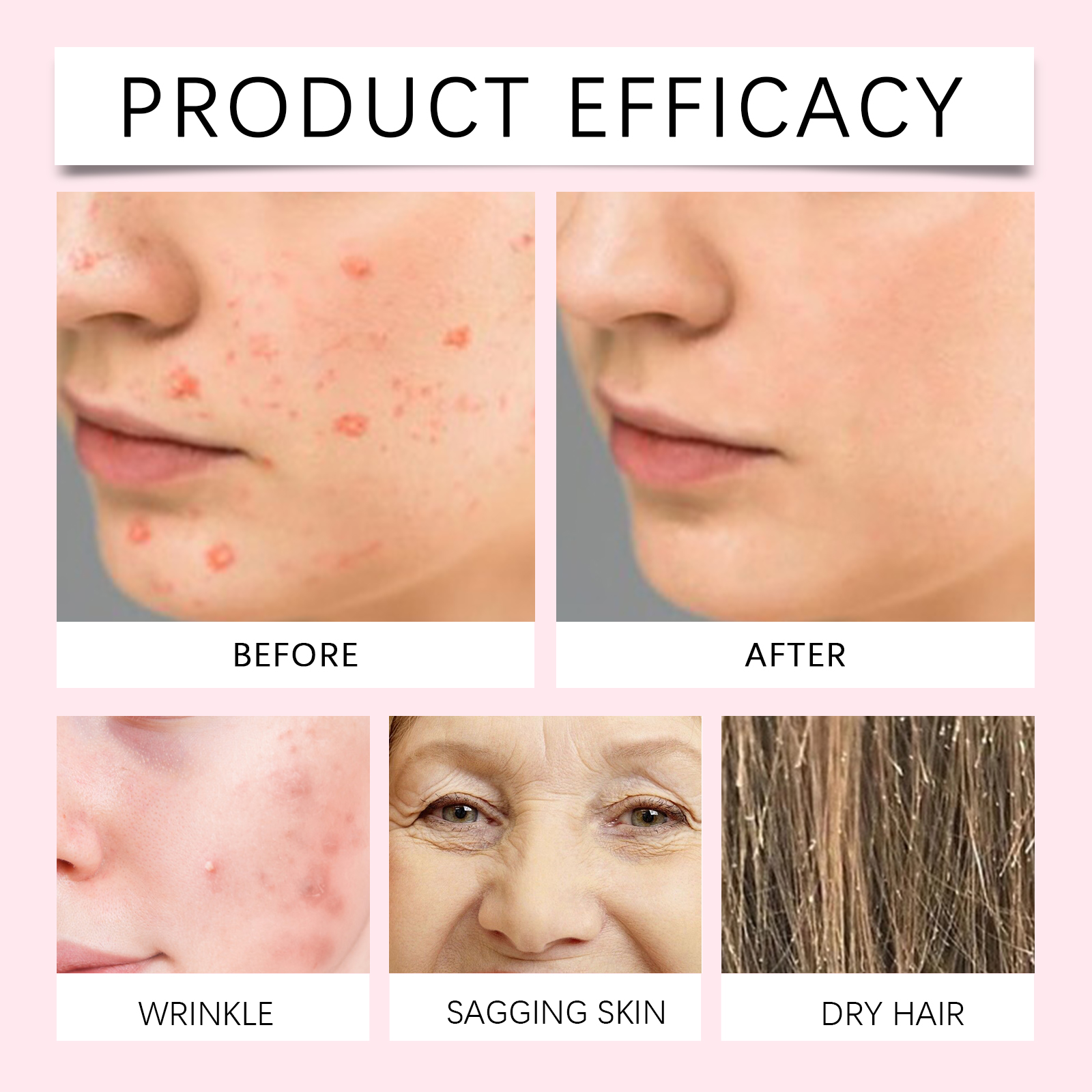 30ml Rosehip Oil For Face Fade - Face Oil Rosehip 评论和价格