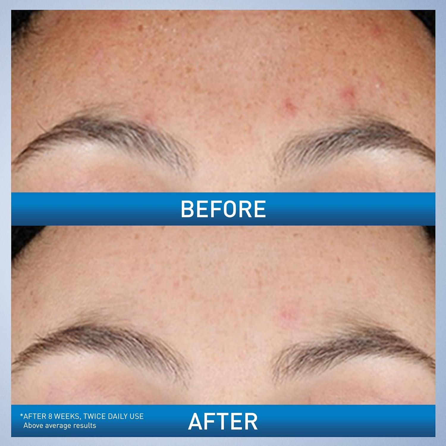 CeraVe Retinol Serum Niacinami - Skincare Non Comedogenic 评论和价格