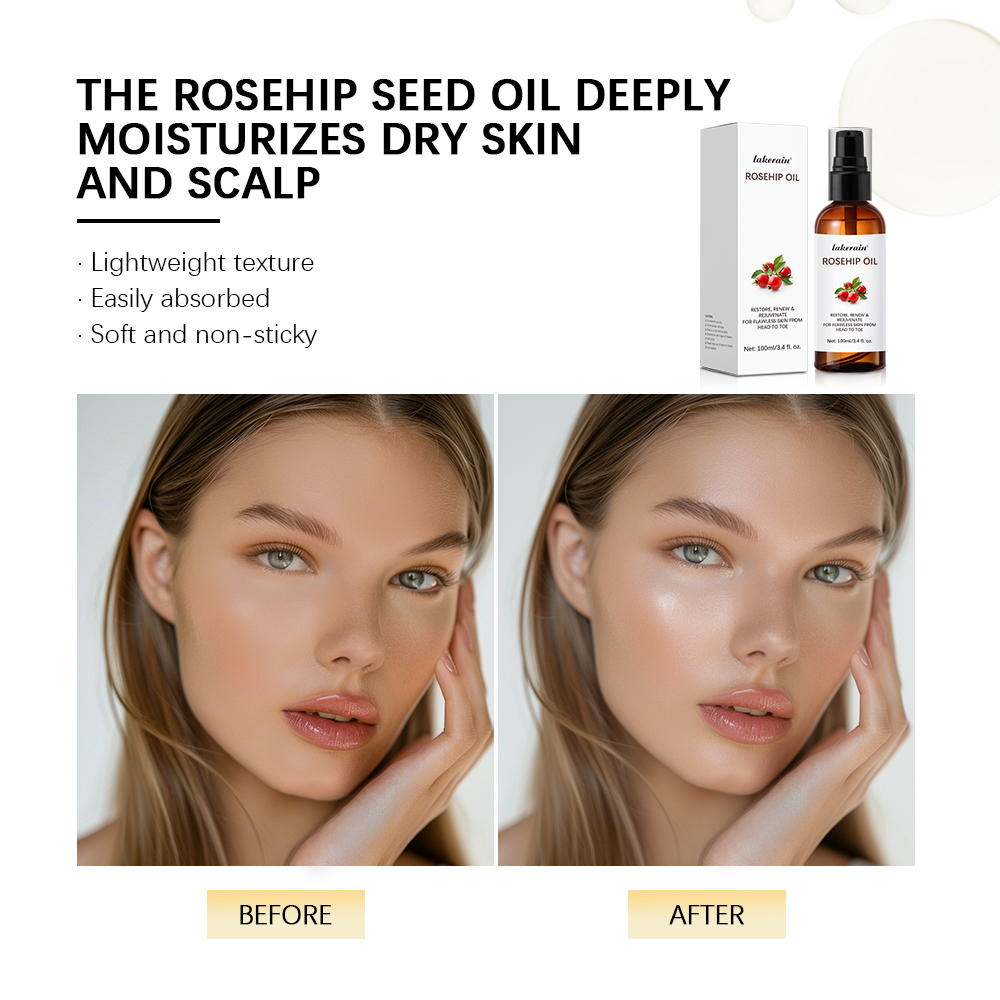 100ml Multifunction Moisturize - Face Oil Rosehip 评论和价格